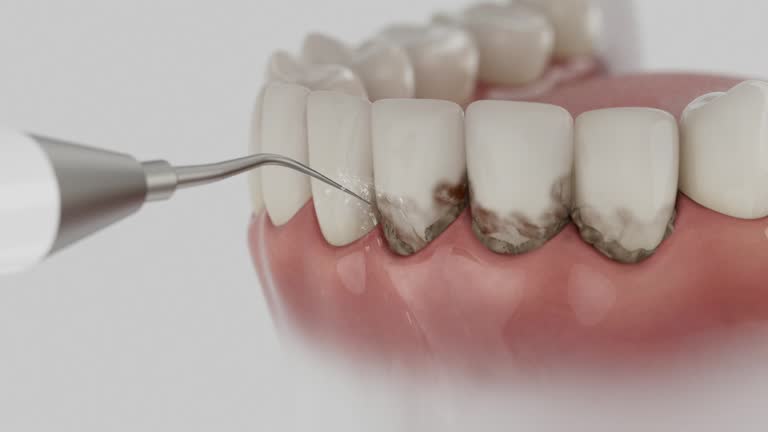 Reliable Emergency Dentist contractor in Lawrence, KS by Smile Center Dentistry